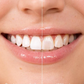 ⏰Limited-Time Sale - BUY 1 GET 1 FREE!!💝5ml Instant Whitening Tooth Paint